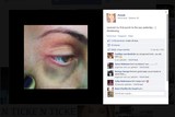 thumbnail: null