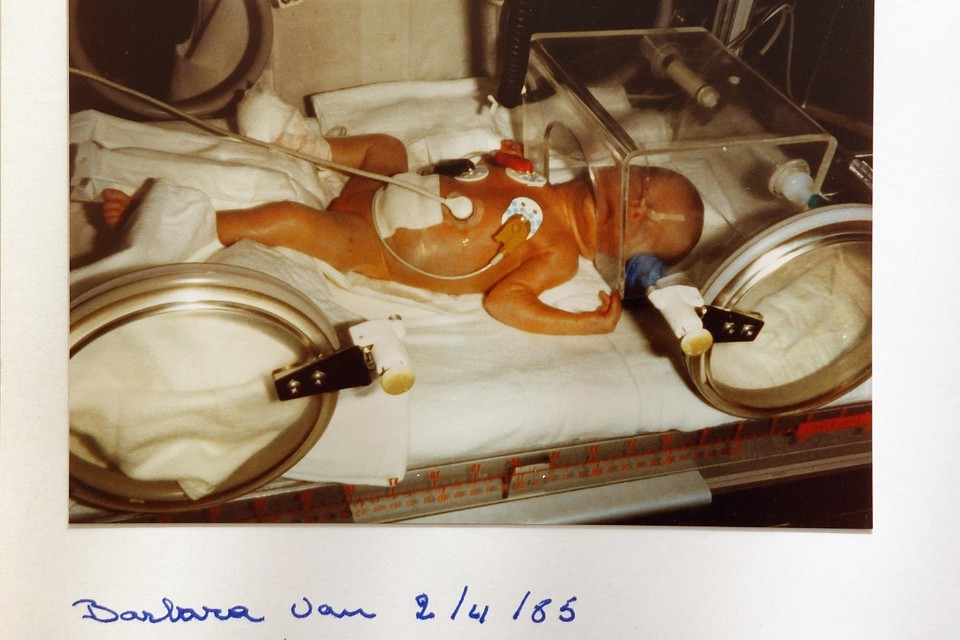 Piepkleine Barbara,vlak na haar vroegtijdige geboorte in de couveuse. 