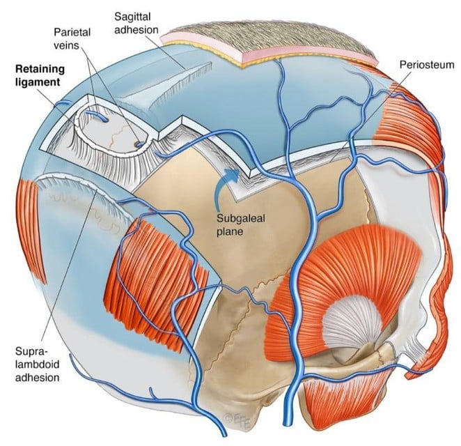 Het cranial retaining ligament, of het craniaal fixerende ligament, ligt op het hoogste puntje van de schedel. Aesthetics Surgery Journal