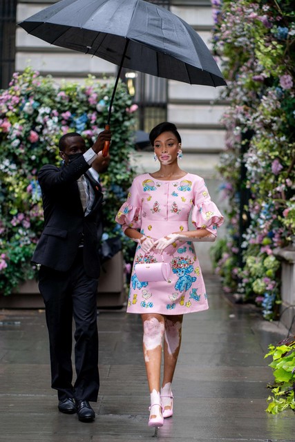 Ook het Canadese model Winnie Harlow was van de partij.