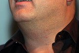thumbnail: null