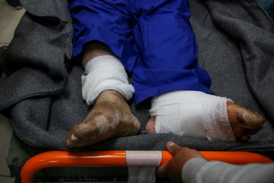 Verwondingen aan de voeten van een vrijgelaten Palestijn.