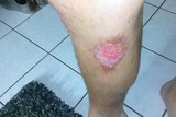 thumbnail: null