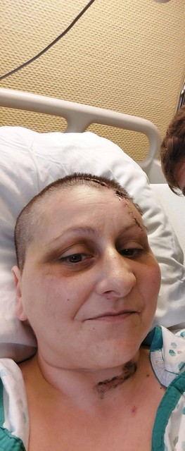 Pasqualina tijdens haar maandenlange revalidatie in het ziekenhuis.