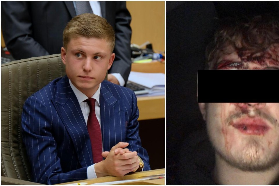 Vlaams Parlementslid Filip Brusselmans (l) plaatste op zijn Facebookpagina het verhaal van een vriend - met foto - die zou zijn aangevallen door vijf Noord-Afrikanen. Niet waar, zo bleek uit onderzoek door de politie. “Maar waarom zou ik hem niet geloven?”